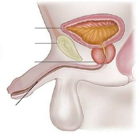 Male cystitis
