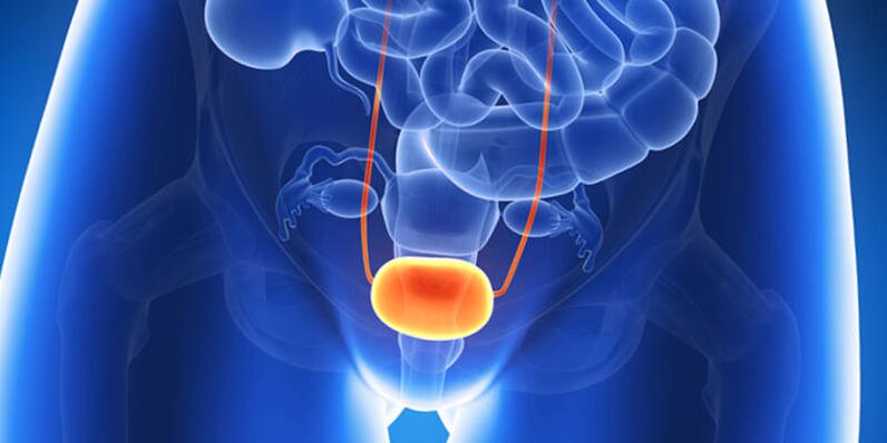 Using pills to treat bladder inflammation